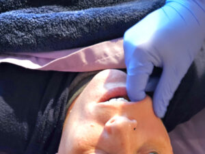 TMJ-intraoral-pic